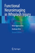 Abbildung von: Functional Neuroimaging in Whiplash Injury - Springer
