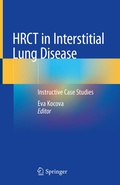 Bild: HRCT in Interstitial Lung Disease - Springer