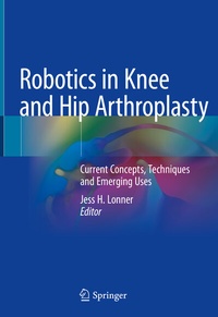 Abbildung von: Robotics in Knee and Hip Arthroplasty - Springer