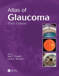 Cover: Atlas of Glaucoma - CRC Press