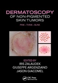 Cover: Dermatoscopy of Non-Pigmented Skin Tumors - CRC Press