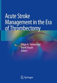 Bild: Acute Stroke Management in the Era of Thrombectomy - Springer