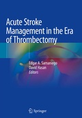 Bild: Acute Stroke Management in the Era of Thrombectomy - Springer