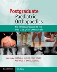 Abbildung von: Postgraduate Paediatric Orthopaedics - Cambridge University Press