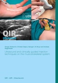 Cover: Ultrasound and clinically guided Injection techniques on the musculoskeletal system - BoD - Books on Demand