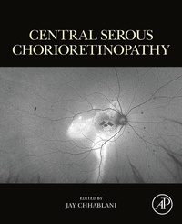 Abbildung von: Central Serous Chorioretinopathy - Academic Press