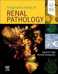 Abbildung von: Diagnostic Atlas of Renal Pathology - Elsevier