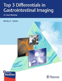 Abbildung von: Top 3 Differentials in Gastrointestinal Imaging - Thieme Publishers