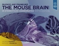 Abbildung von: Paxinos and Franklin's the Mouse Brain in Stereotaxic Coordinates - Academic Press