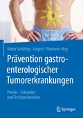 Cover: Pr&auml;vention gastroenterologischer Tumorerkrankungen - Springer