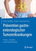 Cover: Pr&auml;vention gastroenterologischer Tumorerkrankungen - Springer