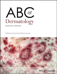 Abbildung von: ABC of Dermatology - Wiley-ISTE