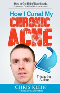 Enlarge image Cover: How I Cured My Chronic Acne: How to Get Rid of Blackheads, Pimples and Zits With a Nutritional Approach - Chris Klein