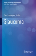 Cover: Glaucoma - Springer