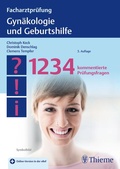 Cover: Facharztpr&uuml;fung Gyn&auml;kologie und Geburtshilfe - Thieme