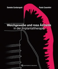 Abbildung von: Weichgewebe und rosa Ästhetik in der Implantattherapie - Quintessenz Verlag