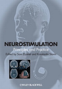 Bild: Neurostimulation - Wiley-Blackwell