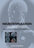 Bild: Neurostimulation - Wiley-Blackwell