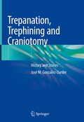 Abbildung von: Trepanation, Trephining and Craniotomy - Springer
