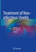 Cover: Treatment of Non-infectious Uveitis - Springer