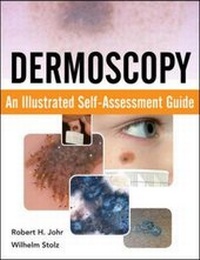 Enlarge image Cover: Dermoscopy: An Illustrated Self-Assessment Guide - McGraw-Hill Medical