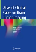 Abbildung von: Atlas of Clinical Cases on Brain Tumor Imaging - Springer