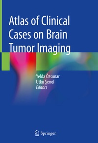 Abbildung von: Atlas of Clinical Cases on Brain Tumor Imaging - Springer