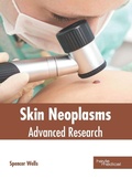 Cover: Skin Neoplasms: Advanced Research - HAYLE MEDICAL