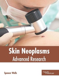 Enlarge image Cover: Skin Neoplasms: Advanced Research - HAYLE MEDICAL