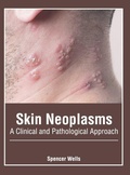 Cover: Skin Neoplasms: A Clinical and Pathological Approach - Foster Academics