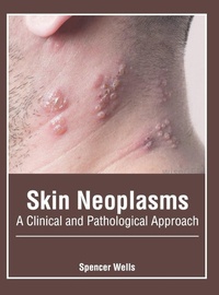 Enlarge image Cover: Skin Neoplasms: A Clinical and Pathological Approach - Foster Academics