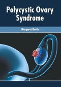Cover: Polycystic Ovary Syndrome - Foster Academics