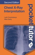 Cover: Pocket Tutor Chest X-Ray Interpretation - JP Medical Ltd
