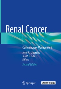 Abbildung von: Renal Cancer - Springer