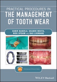 Enlarge image Cover: Practical Procedures in the Management of Tooth Wear - Wiley-ISTE