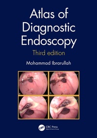 Abbildung von: Atlas of Diagnostic Endoscopy, 3E - CRC Press