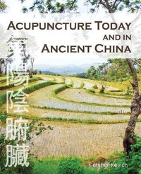 Abbildung von: Acupuncture Today and in Ancient China - CuriousPages Publishing