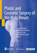 Bild: Plastic and Cosmetic Surgery of the Male Breast - Springer
