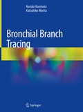 Bild: Bronchial Branch Tracing - Springer