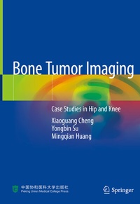 Abbildung von: Bone Tumor Imaging - Springer