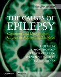 Cover: Causes of Epilepsy - Cambridge University Press