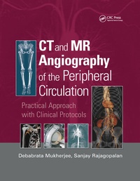 Enlarge image Cover: CT and MR Angiography of the Peripheral Circulation - CRC Press