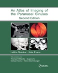 Cover: Atlas of Imaging of the Paranasal Sinuses, Second Edition - CRC Press