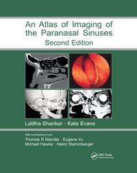 Enlarge image Cover: Atlas of Imaging of the Paranasal Sinuses, Second Edition - CRC Press