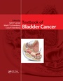 Cover: Textbook of Bladder Cancer - CRC Press