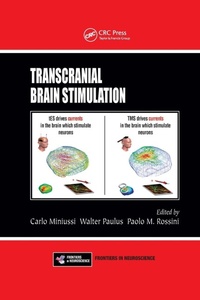Abbildung von: Transcranial Brain Stimulation - CRC Press