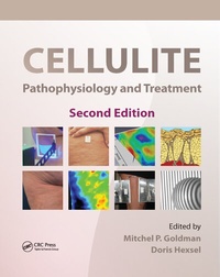 Enlarge image Cover: Cellulite - CRC Press