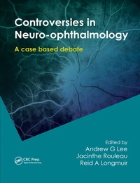 Abbildung von: Controversies in Neuro-Ophthalmology - CRC Press