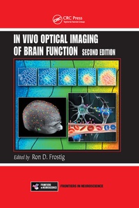 Abbildung von: In Vivo Optical Imaging of Brain Function - CRC Press