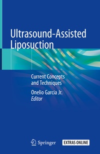 Abbildung von: Ultrasound-Assisted Liposuction - Springer